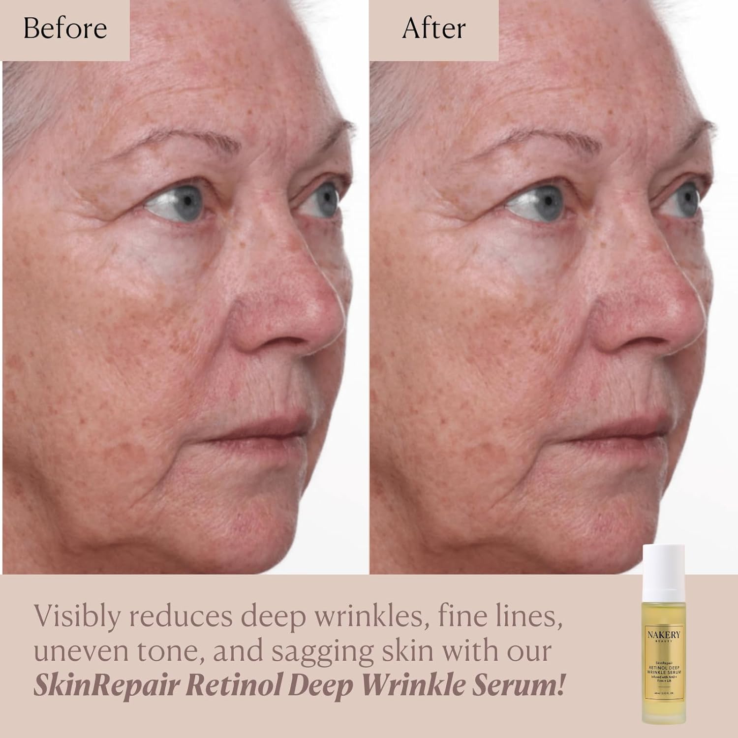 Nakery SkinRepair Retinol Deep Wrinkle Serum (2.02 Fl Oz), Anti Aging Face Serum with Encapsulated Retinol, NAD+ Complex, Ceramide NP, Hydrating Firming Skin Treatment for Fine Lines