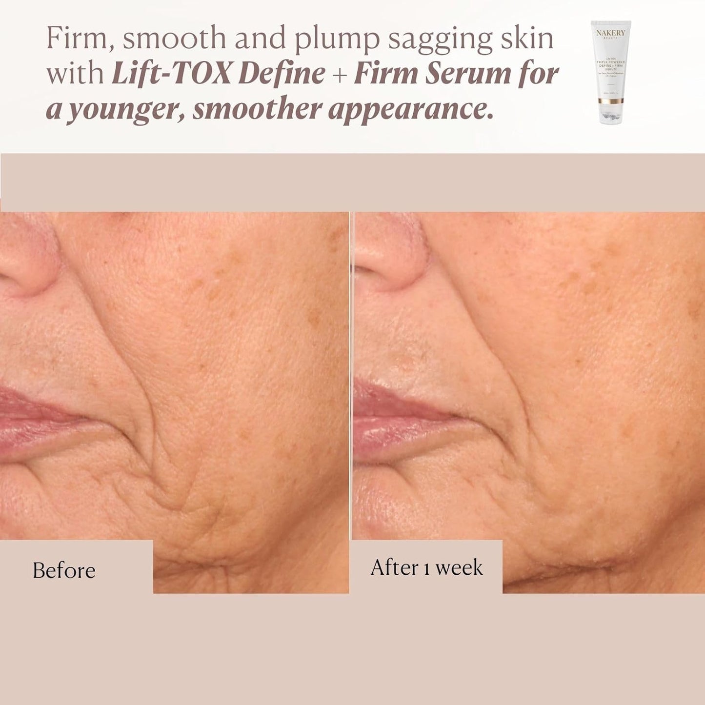 Nakery Lift-Tox Define & Firm Face Tightening Treatment with NAD+ & Collagen Booster, Neck & Jawline Roller for Sagging Skin, Lifting Wrinkles, Jowls, Crepey Texture, Firming for Women 50+