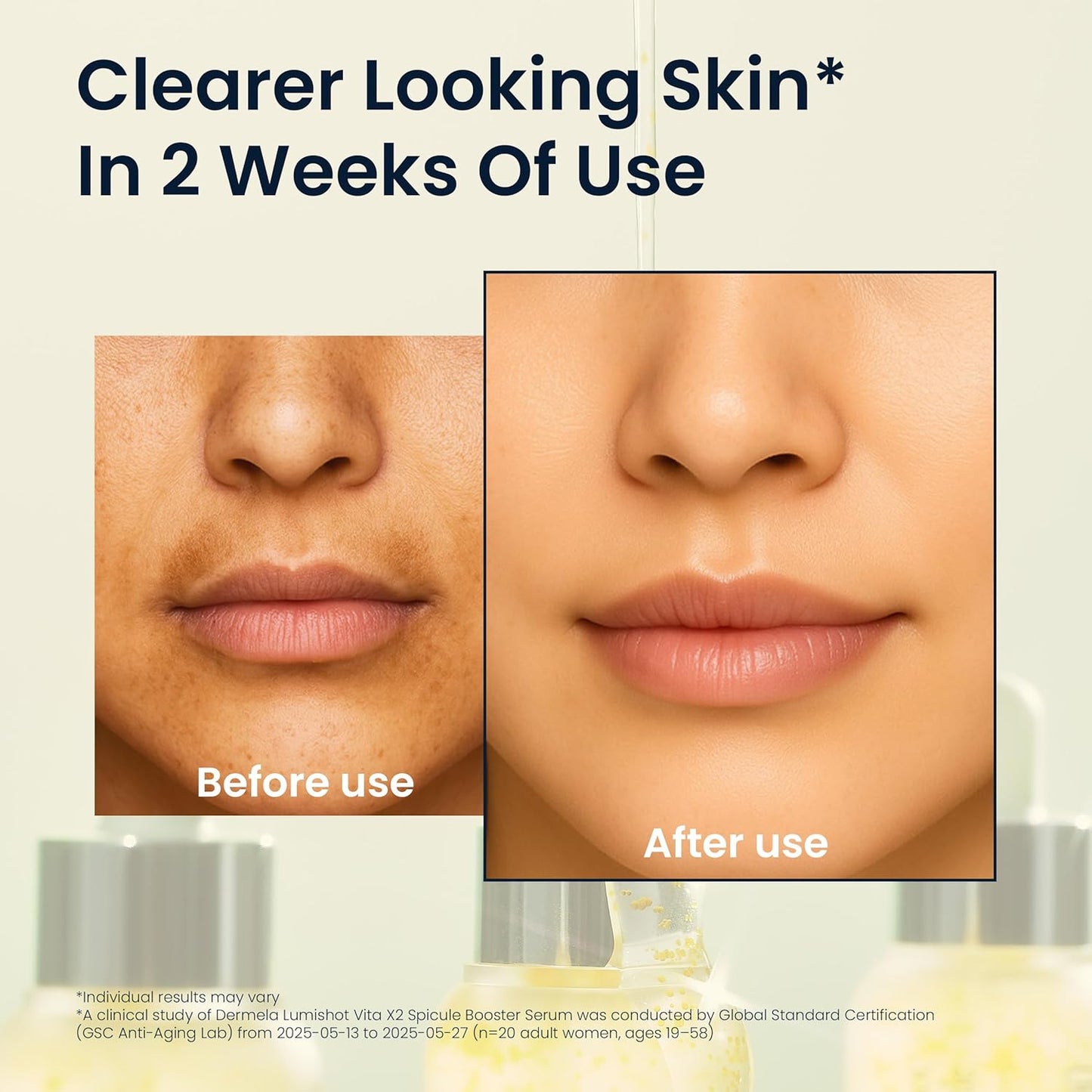 Lumishot Vita X2 Spicule Booster Serum, Vegan Spicules with Vitamin C + Niacinamide, Glutathione & Panthenol, Brightening & Texture Care 1.01 fl oz (30ml) | Korean Face Serum for Uneven Tone